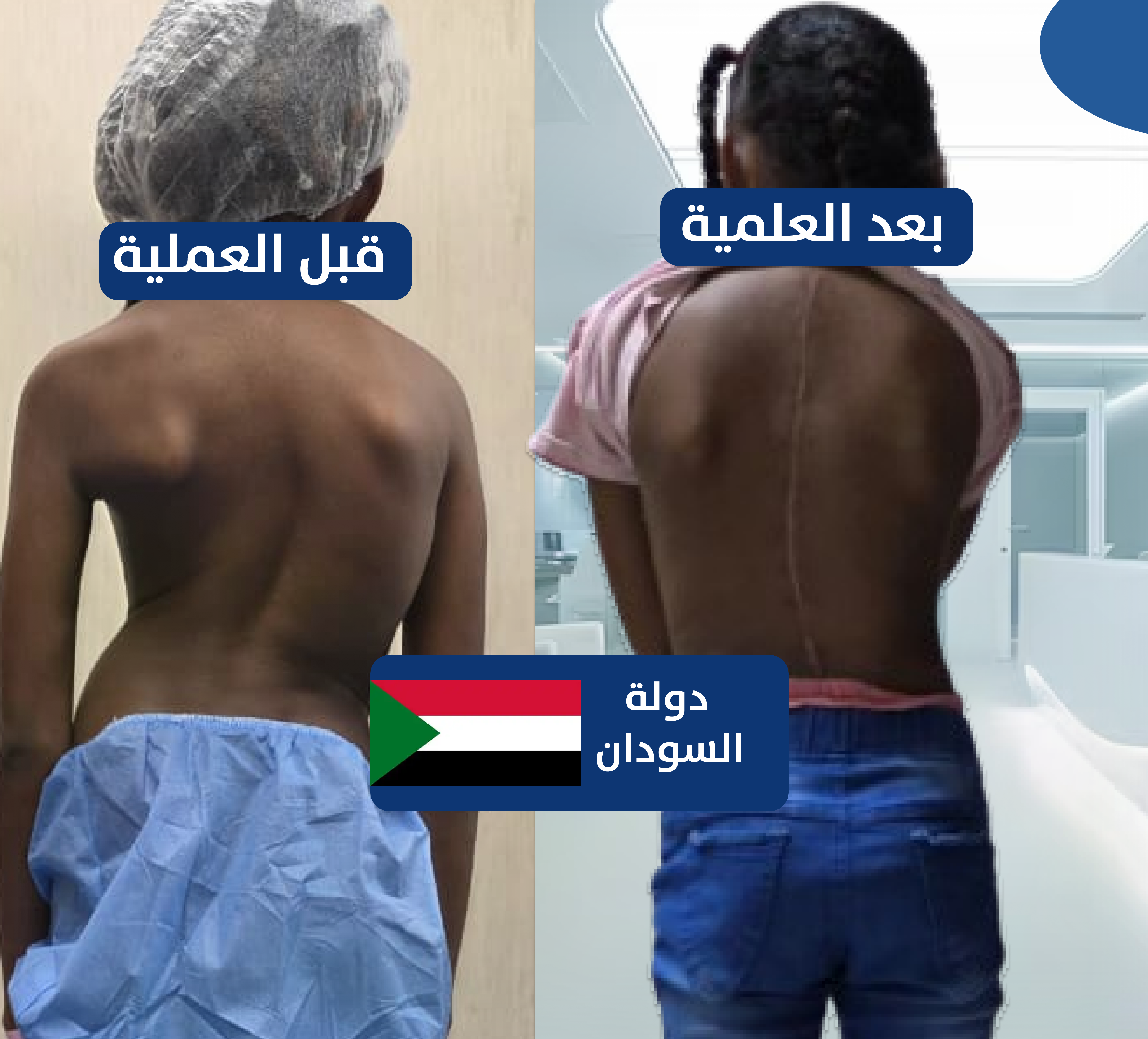 حالة جنف